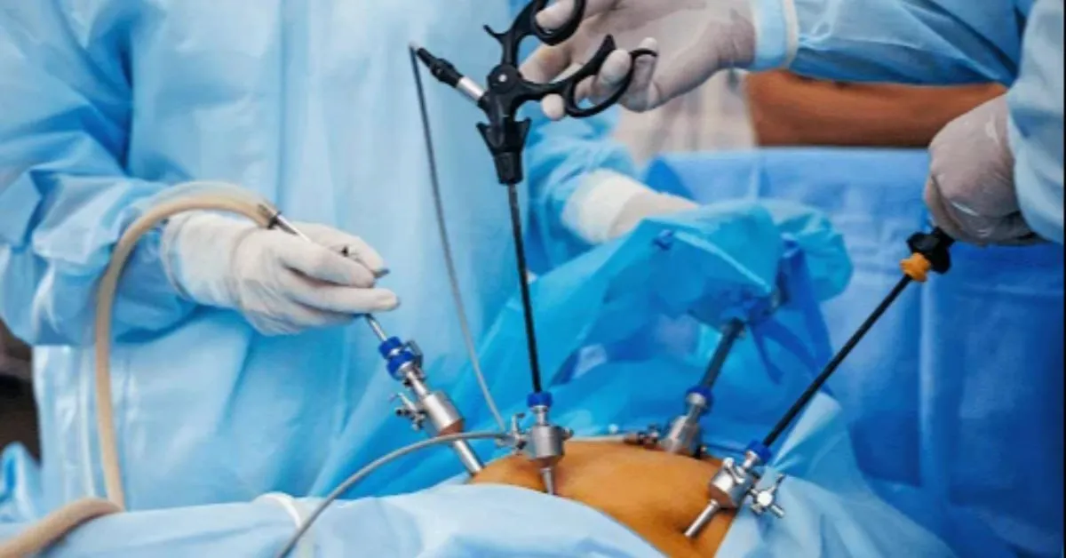 Imagem ilustrativa da notícia: Saiba as novas regras para fazer cirurgia bariátrica no Brasil