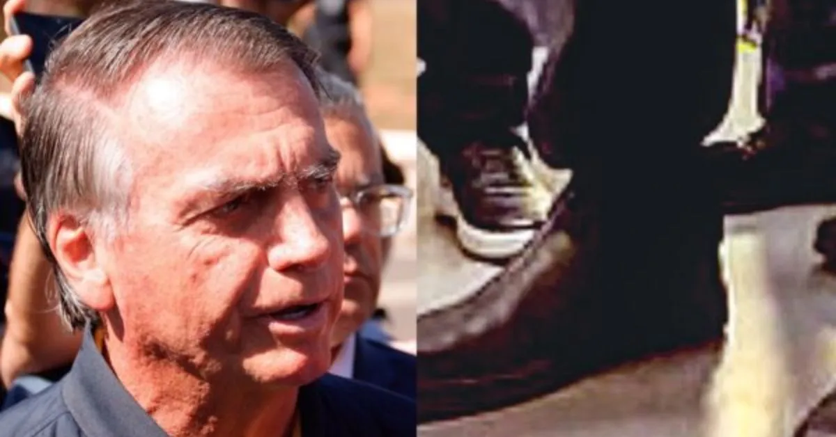 Imagem ilustrativa da notícia: Como funciona a tornozeleira eletrônica usada por Bolsonaro