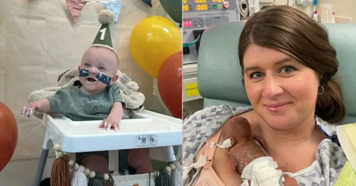Imagem ilustrativa da notícia: Bebê mais prematuro do mundo completa um ano de vida