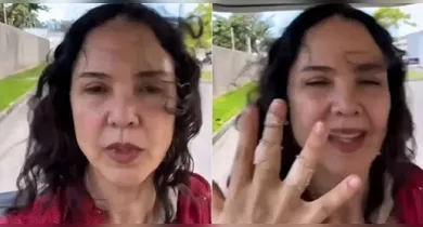 Imagem ilustrativa da notícia: Tereza Seiblitz se machuca na Dança dos Famosos e exibe ferimentos