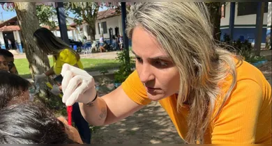 Imagem ilustrativa da notícia: Limpeza dental previne gengivite, alerta ortodontista paraense