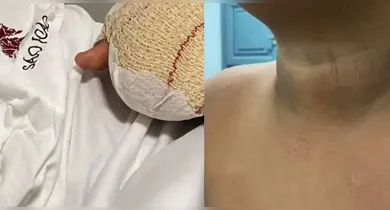 Imagem ilustrativa da notícia: Menino brasileiro perde dedos após violência em escola de Portugal