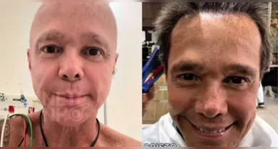 Imagem ilustrativa da notícia: Após tratar câncer, Netinho comemora crescimento de cabelo