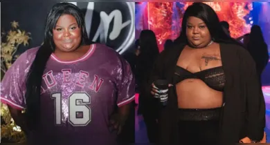 Imagem ilustrativa da notícia: MC Carol gasta R$ 100 mil em cirurgias plásticas. Veja resultado!