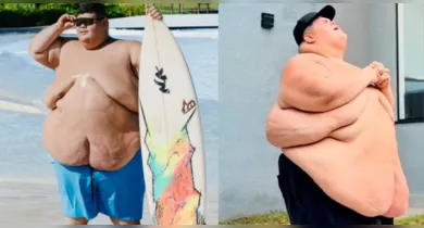 Imagem ilustrativa da notícia: Gordão da XJ perde 115 kg e impressiona. Veja o antes e depois