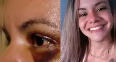 Imagem ilustrativa da notícia: Mulher que levou 61 socos diz por que não se separou de agressor