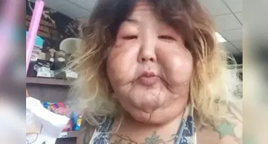 Imagem ilustrativa da notícia: Veja como era Juju do Pix antes de aplicar óleo mineral no rosto