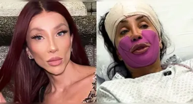 Imagem ilustrativa da notícia: Maya Massafera relata dor intensa após procedimento para afinar o rosto