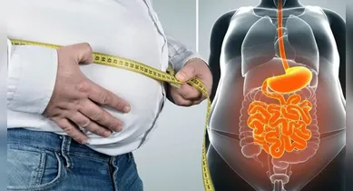 Imagem ilustrativa da notícia: Fim da barriga de chope: 5 dicas para reduzir a gordura visceral