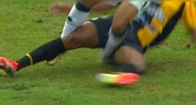 Imagem ilustrativa da notícia: Marcelinho pode perder a temporada 2025 do Remo