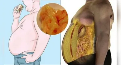 Imagem ilustrativa da notícia: 7 hábitos comprovados para reduzir a gordura abdominal