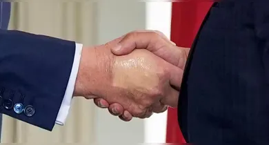 Imagem ilustrativa da notícia: Trump reaparece com mão maquiada após diagnóstico de doença