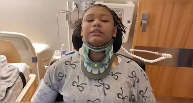 Imagem ilustrativa da notícia: Acidente em cama elástica deixa adolescente tetraplégica