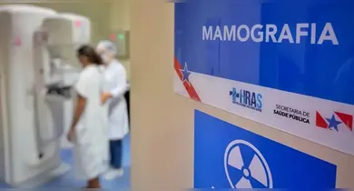 Imagem ilustrativa da notícia: Mamografia: veja como fazer exames de graça no Pará