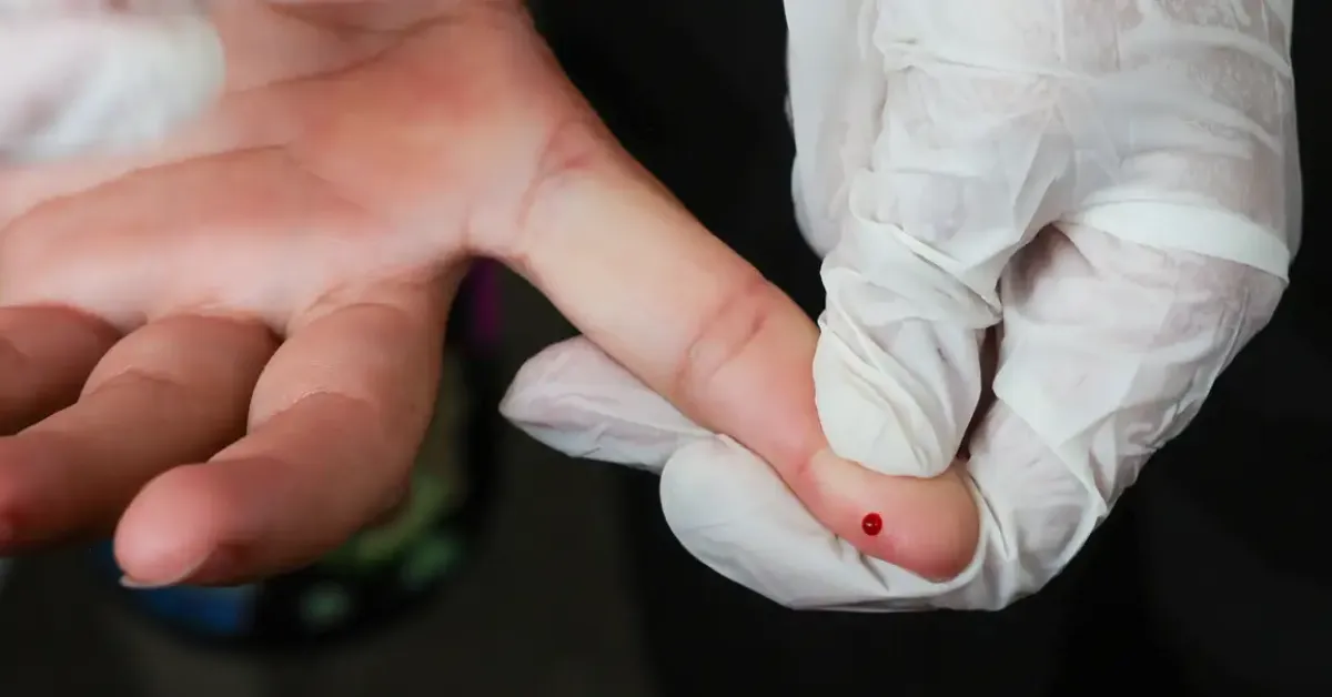 Imagem ilustrativa da notícia: SUS oferece teste rápido para dengue com resultado em minutos