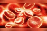 A doença se caracteriza pela multiplicação desordenada das células brancas, que substituem as células saudáveis do sangue.