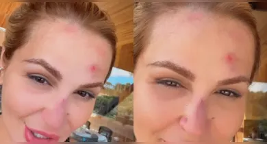 Imagem ilustrativa da notícia: VÍDEO: Deolane Bezerra mostra rosto machucado e gera preocupação