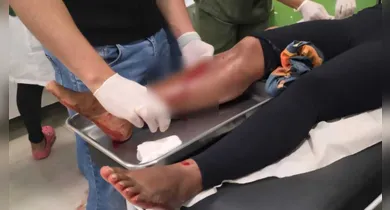 Imagem ilustrativa da notícia: Mulher baleada em Tucumã é socorrida pelo marido 