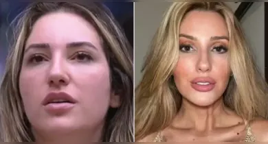 Imagem ilustrativa da notícia: Ex-BBB Amanda Meirelles reage às críticas sobre mudanças no rosto