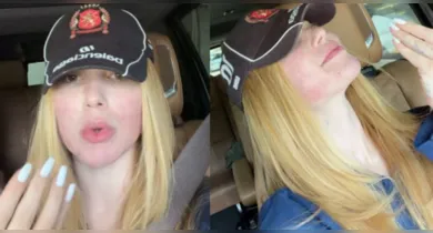 Imagem ilustrativa da notícia: Após reação, Virginia desabafa sobre procedimento no rosto