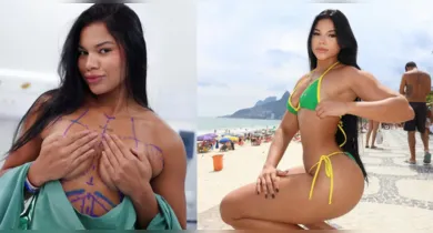 Imagem ilustrativa da notícia: Influenciadora paraense mostra detalhes de lipo e silicone 