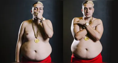 Imagem ilustrativa da notícia: MC Binn perde mais de 50 kg sem cirurgia; veja antes e depois!