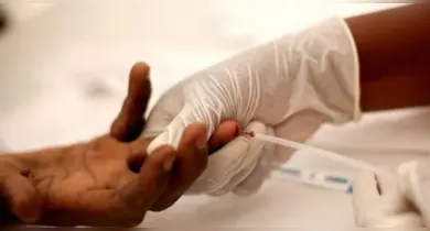 Imagem ilustrativa da notícia: Belém registra queda nos casos de HIV/Aids em 2025