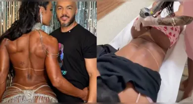 Imagem ilustrativa da notícia: Gracyanne Barbosa começar a remover tatuagem em homenagem a Belo