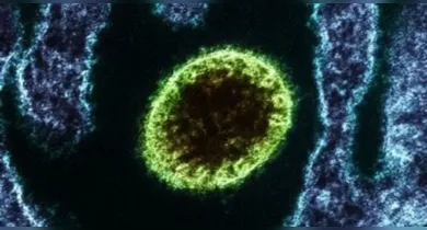 Imagem ilustrativa da notícia: Nipah: Qual é o risco do vírus chegar ao Brasil após novos casos na Índia?