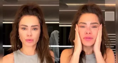 Imagem ilustrativa da notícia: Dermatologista explica mudanças no rosto de Carolina Dieckmann