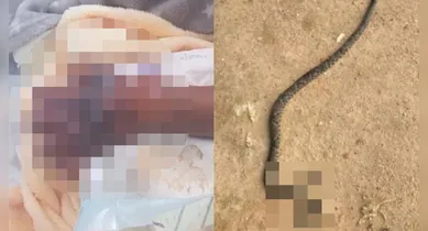 Imagem ilustrativa da notícia: Criança de 5 anos é internada após picada de cobra no Pará