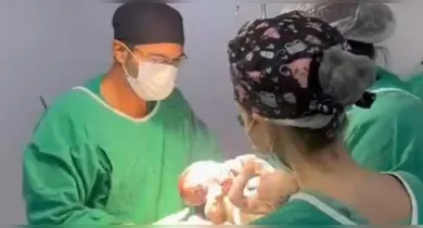 Imagem ilustrativa da notícia: Siameses nascem com três pernas e desafiam a medicina; caso é de alto complexidade