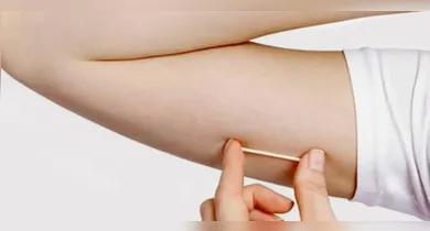 Imagem ilustrativa da notícia: Implanon: saiba como colocar o contraceptivo de graça no Pará