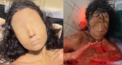 Imagem ilustrativa da notícia: Protagonista de novela surge 'sem olhos e sem boca' em filme