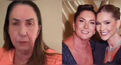 Imagem ilustrativa da notícia: Mãe de Virginia descobre grave lesão no tórax após acidente