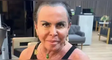 Imagem ilustrativa da notícia: Gretchen aparece sem prótese capilar e anuncia doação de sua lace