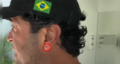 Imagem ilustrativa da notícia: Já olhou sua orelha? Sinal pouco conhecido pode indicar um risco de infarto