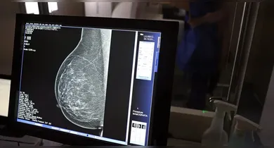 Imagem ilustrativa da notícia: Nova lei reforça direito a 3 folgas por ano para exames preventivos