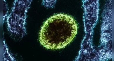 Imagem ilustrativa da notícia: Nipah: conheça o vírus com alta mortalidade que causou surto na Índia