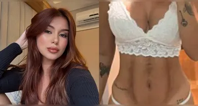 Imagem ilustrativa da notícia: Influencer acusa clínica estética de “deformar” seu corpo; veja