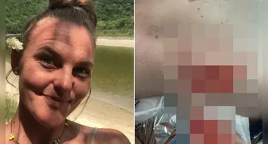 Imagem ilustrativa da notícia: Capivara ataca e arranca pedaço de nádega de mulher, em Florianópolis