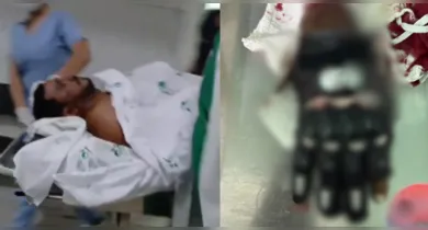 Imagem ilustrativa da notícia: Mototaxista tem mão amputada após agressão com facão em Castanhal