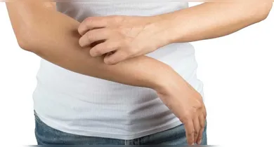 Imagem ilustrativa da notícia: Esses são os sinais na pele que podem indicar gordura no fígado