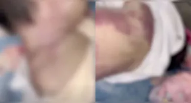 Imagem ilustrativa da notícia: Criança de 2 meses é encontrada morta com diversas marcas pelo corpo