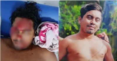 A vítima utilizava uma serra elétrica para cortar um pedaço de madeira com o objetivo de fazer ajustes em sua embarcação