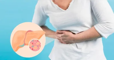 Silenciosa nas fases iniciais, a gordura no fígado costuma ser descoberta em exames de rotina e exige mudança de hábitos para evitar complicações mais graves.