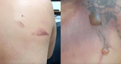 Vítima relatou que já havia sido alvo de outras violências em situações anteriores.