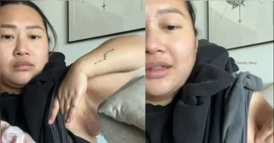 Influenciadora destaca terceiro mamilo