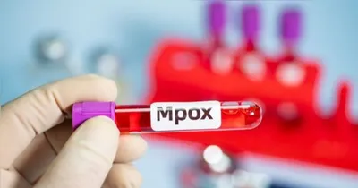 A infecção foi registrada no município de Colatina, no noroeste capixaba.