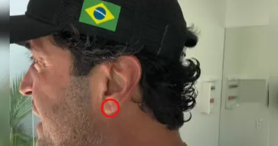 Sinal foi observado na orelha do influenciador Henrique Maderite, após ter sua morte confirmada em decorrência de um infarto.